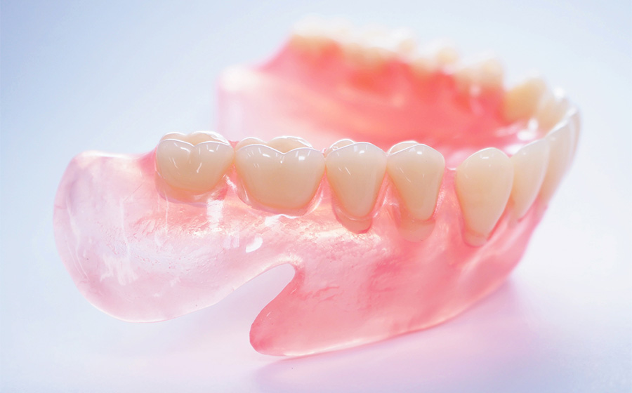 入れ歯(義歯)