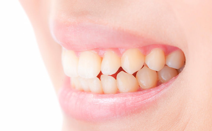 歯ぎしり・食いしばり